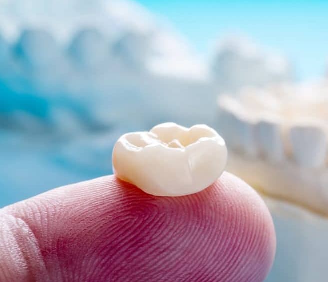 dental crowns duluth