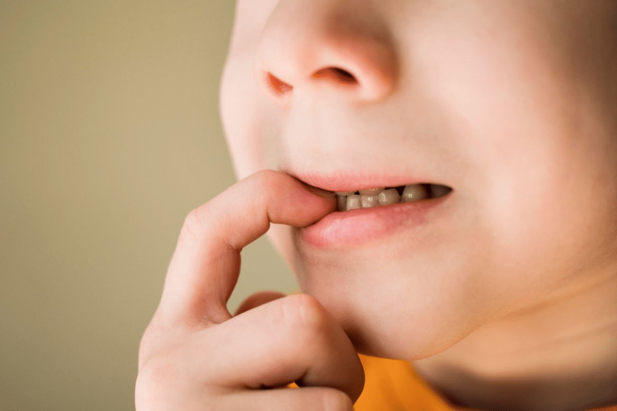 Mouth Guard for 6-Year-Old Grinding Teeth