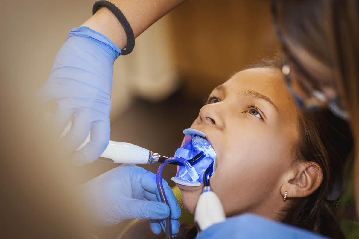 Dental Filling Treatment