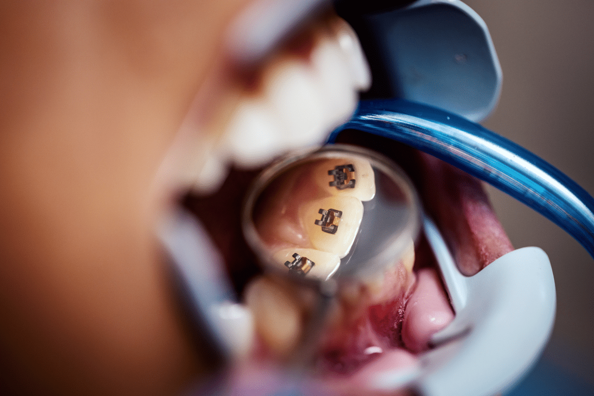 pediatric crown dentist