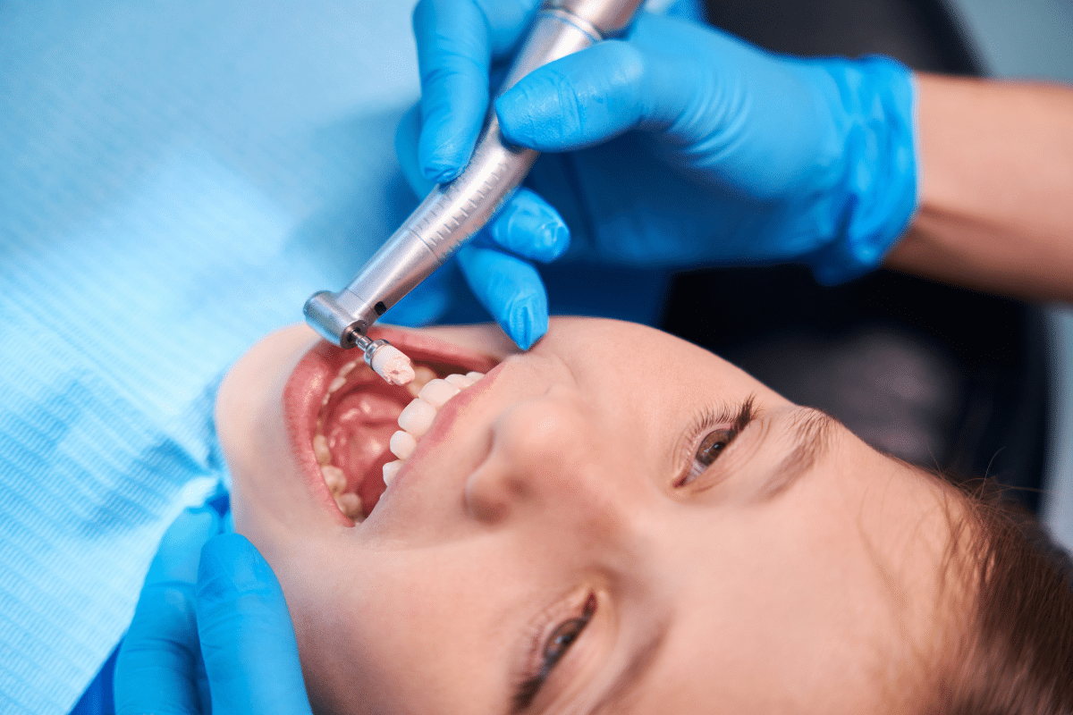 kid's dental fillings